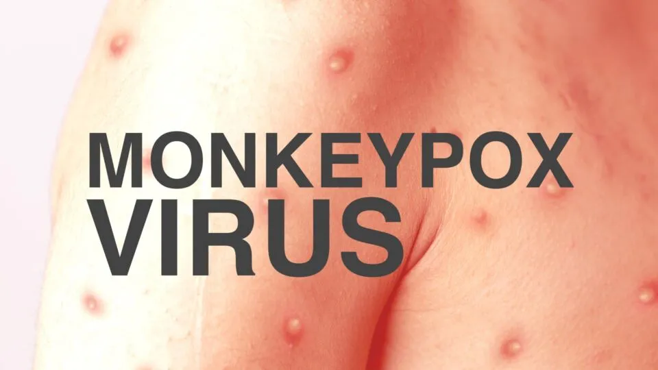 What is monkeypox What is monkeypox