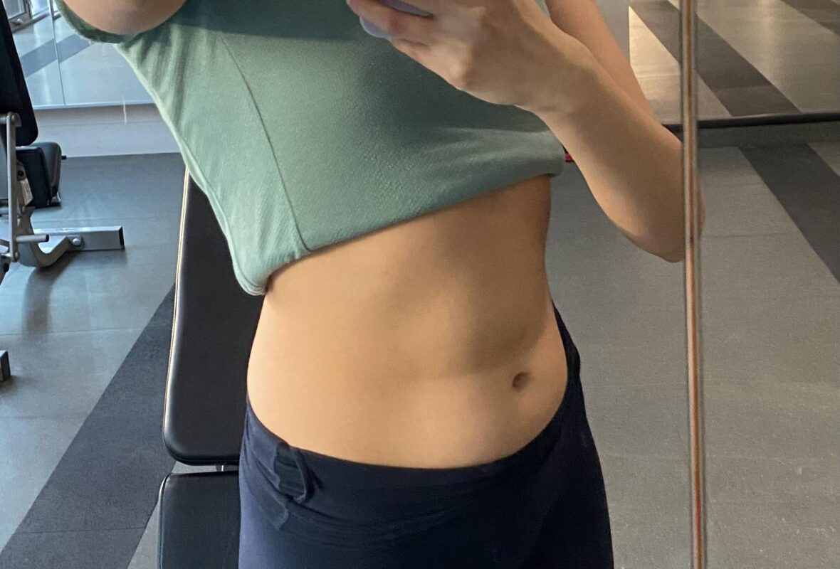 How To Get Rid Of Creases On My Belly How To Get Rid Of Creases On My Belly