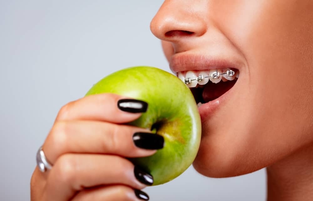 What To Eat With Braces The First Week What To Eat With Braces The First Week